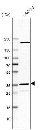 Western blot analysis in human cell line CACO-2.