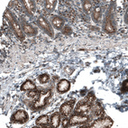 Immunohistochemical staining of human duodenum shows strong granular cytoplasmic positivity in glandular cells.