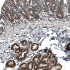 Immunohistochemical staining of human duodenum shows strong granular cytoplasmic positivity in glandular cells.