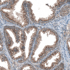 Immunohistochemical staining of human prostate shows strong granular cytoplasmic positivity in glandular cells.