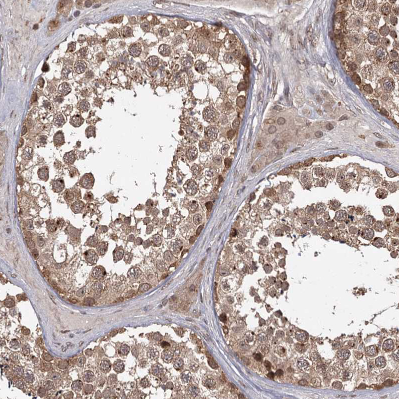 Anti-TBC1D23 Antibody