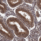Immunohistochemical staining of human endometrium shows moderate positivity in Golgi apparatus in glandular cells.