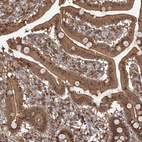 Immunohistochemical staining of human upper gastrointestinal shows moderate positivity in Golgi apparatus in glandular cells.