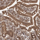 Immunohistochemical staining of human upper gastrointestinal shows moderate positivity in Golgi apparatus in glandular cells.