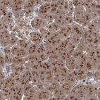 Immunohistochemical staining of human pancreas shows moderate to strong positivity in Golgi apparatus in exocrine glandular cells.