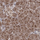 Immunohistochemical staining of human pancreas shows moderate to strong positivity in Golgi apparatus in exocrine glandular cells.