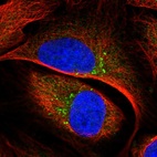 Immunofluorescent staining of human cell line U-2 OS shows localization to the Golgi apparatus.