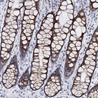 Immunohistochemical staining of human colon shows strong cytoplasmic positivity in glandular cells.
