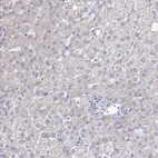 Immunohistochemical staining of human liver shows no positivity in hepatocytes as expected.