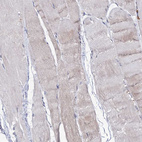 Immunohistochemical staining of human skeletal muscle shows no cytoplasmic positivity in myocytes as expected.