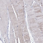 Immunohistochemical staining of human skeletal muscle shows no cytoplasmic positivity in myocytes as expected.