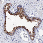Immunohistochemical staining of human prostate shows strong cytoplasmic positivity in glandular cells.
