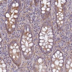 Anti-EEA1 Antibody