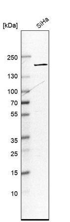 Western blot analysis in human cell line SiHa.