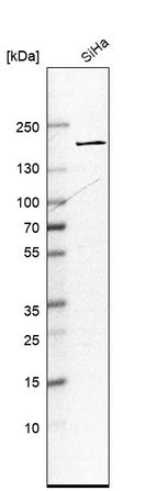Western blot analysis in human cell line SiHa.