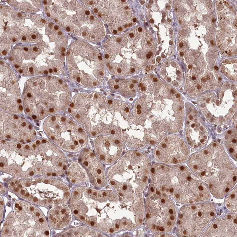 Anti-CEP83 Antibody