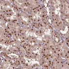 Anti-CEP83 Antibody