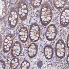 Immunohistochemical staining of human colon shows strong cytoplasmic positivity in glandular cells.