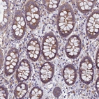 Immunohistochemical staining of human colon shows strong cytoplasmic positivity in glandular cells.