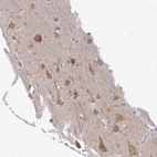 Immunohistochemical staining of human cerebral cortex shows strong cytoplasmic positivity in neurons.