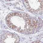 Immunohistochemical staining of human testis shows strong cytoplasmic positivity in cells in seminiferous ducts.