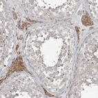 Anti-RASSF8 Antibody