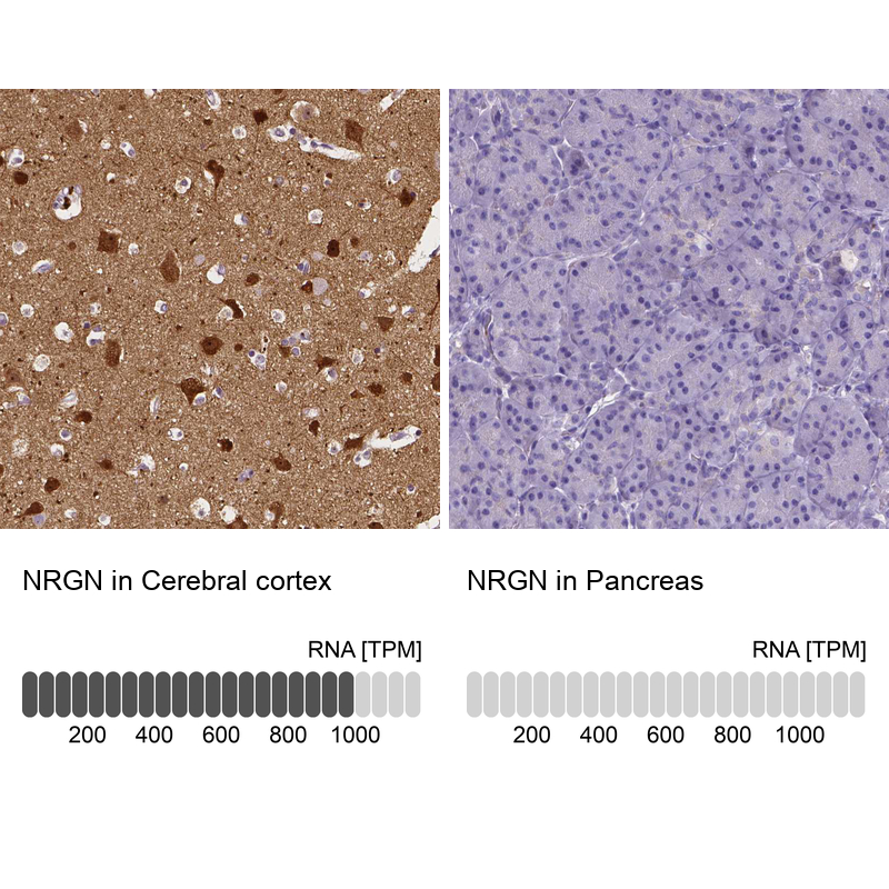 Anti-NRGN Antibody