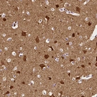 Immunohistochemical staining of human cerebral cortex shows strong cytoplasmic positivity in neurons.