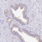 Immunohistochemical staining of human prostate shows weak membranous positivity in glandular cells.