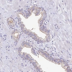 Immunohistochemical staining of human prostate shows weak membranous positivity in glandular cells.