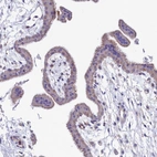 Immunohistochemical staining of human placenta shows weak cytoplasmic positivity in trophoblastic cells.