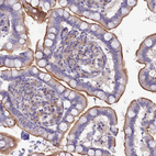 Immunohistochemical staining of human small intestine shows strong membranous positivity in glandular cells.
