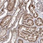Immunohistochemical staining of human kidney shows strong granular cytoplasmic positivity in cells in tubules.