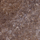 Immunohistochemical staining of human tonsil shows strong granular cytoplasmic positivity in germinal and non-germinal center cells.