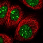 Immunofluorescent staining of human cell line A-431 shows localization to nucleus & nucleoli.