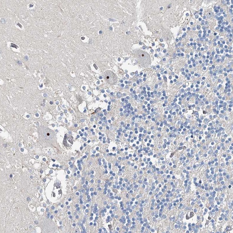 Anti-RBM43 Antibody