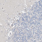 Anti-RBM43 Antibody