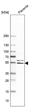 Western blot analysis in human placenta tissue.