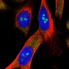 Immunofluorescent staining of human cell line U-251 MG shows localization to nucleoli fibrillar center & cytosol.
