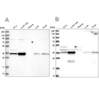 Western blot analysis using Anti-GPATCH11 antibody HPA038231 (A) shows similar pattern to independent antibody HPA038232 (B).