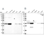 Western blot analysis using Anti-GPATCH11 antibody HPA038231 (A) shows similar pattern to independent antibody HPA038232 (B).