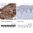 Anti-TRDN Antibody