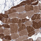 Immunohistochemical staining of human skeletal muscle shows high expression.
