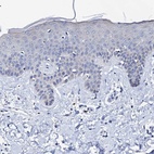 Anti-TRDN Antibody