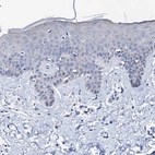 Immunohistochemical staining of human skin shows low expression as expected.