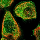 Immunofluorescent staining of human cell line A-431 shows localization to plasma membrane & cytosol.