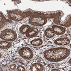 Immunohistochemical staining of human stomach shows strong cytoplasmic positivity in glandular cells.