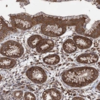Immunohistochemical staining of human stomach shows strong cytoplasmic positivity in glandular cells.