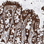 Immunohistochemical staining of human colon shows strong cytoplasmic positivity in glandular cells.