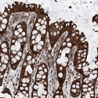 Immunohistochemical staining of human colon shows strong cytoplasmic positivity in glandular cells.